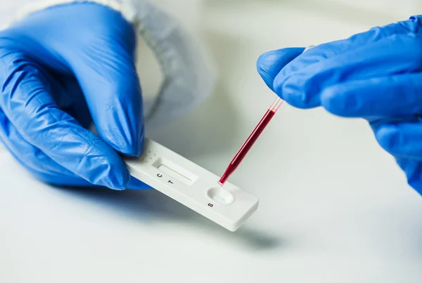 COVID Antibody Test